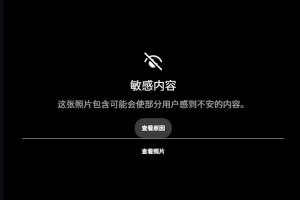 露骨!慎入!范德彪小拇指的骨头直接刺出来了!